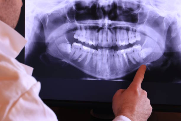 Best Chipped Tooth Repair Near Me  in Utqiagvik, AK