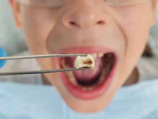 Best Urgent Dental Care  in Utqiagvik, AK